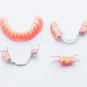 exampke of partial denture, FOUNDATIONS OF HEALTH DENTAL CARE, (816) 233-0142.